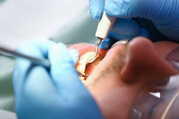 Best Broken or Cracked Tooth Emergency Dentist in Cookeville, TN