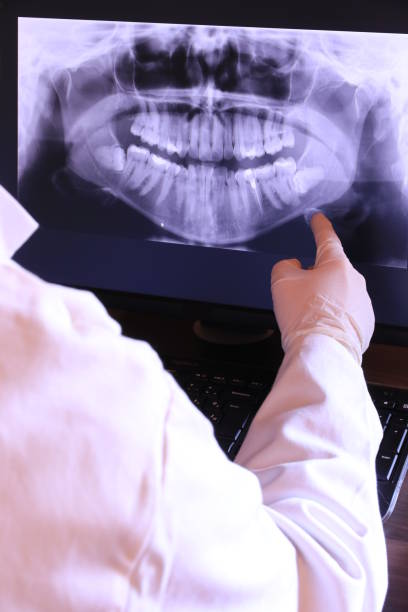 Best Emergency Dentist for Lost Fillings or Crowns in Cookeville, TN